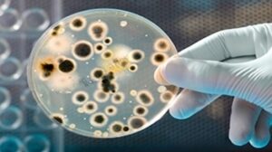 Infectious Diseases