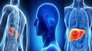Medical Oncology