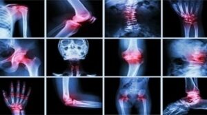 Rheumatology